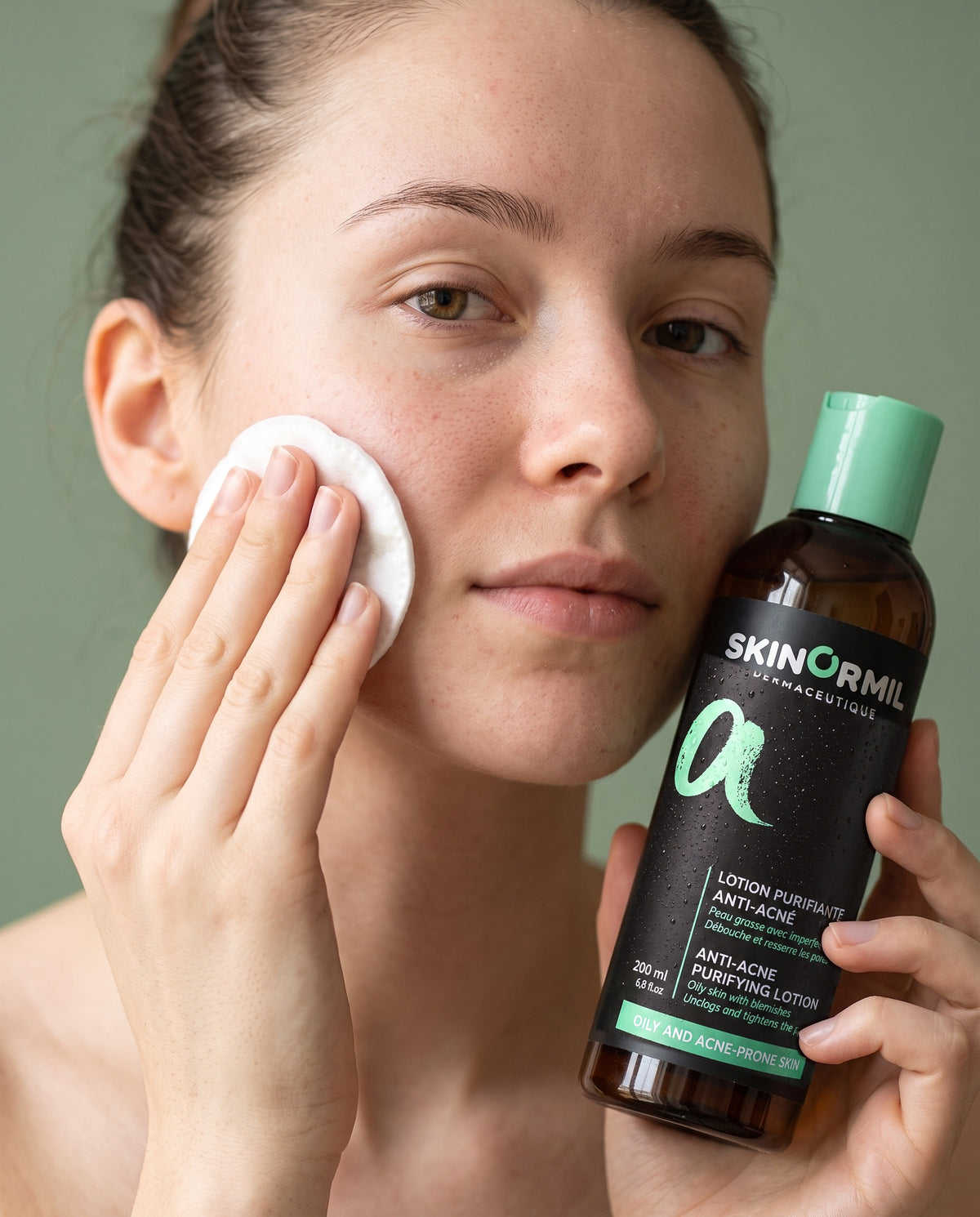 Oily, blemish-prone skin
